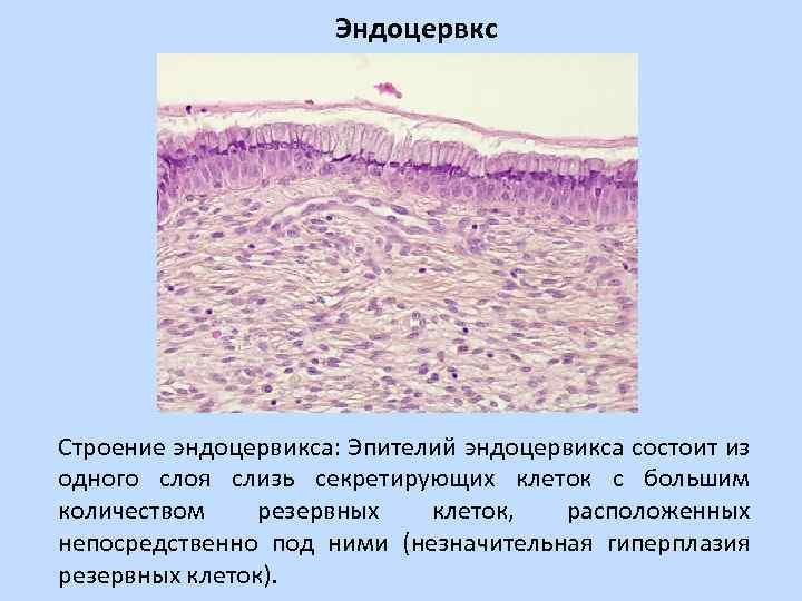 Простая железистая гиперплазия эндометрия микропрепарат рисунок фото