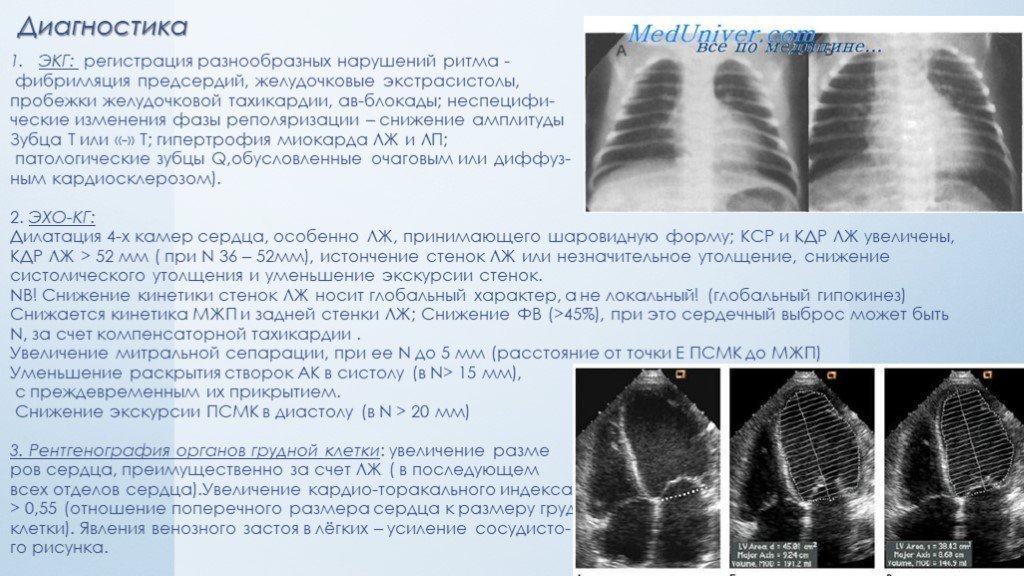 Усиление сосудистого рисунка легких на рентгене фото